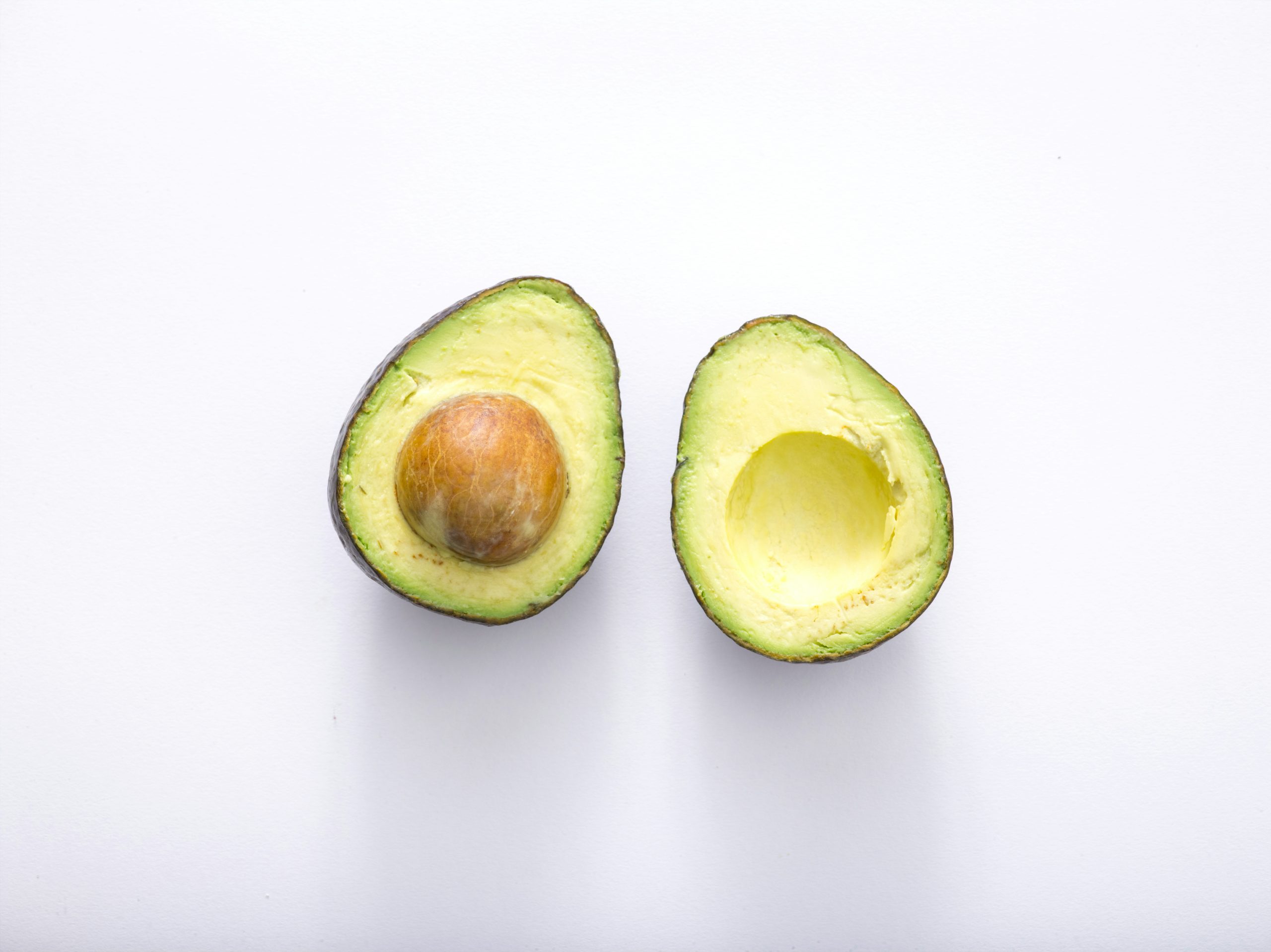 avocado health benefits heart brain natural medicine 🌿
